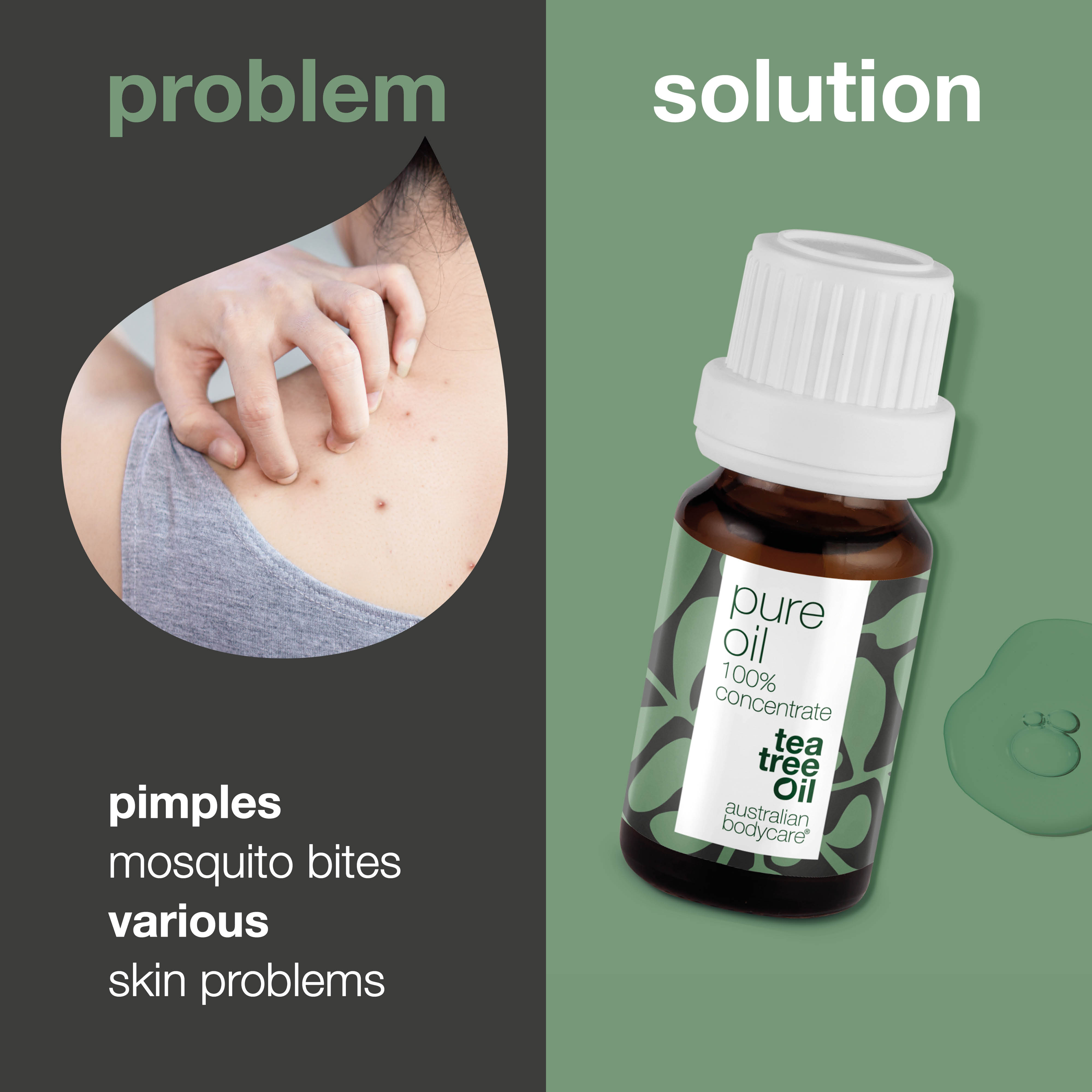 Cilt sorunları için saf çay ağacı yağı — Avustralya’dan %100 doğal ve konsantre çay ağacı yağı