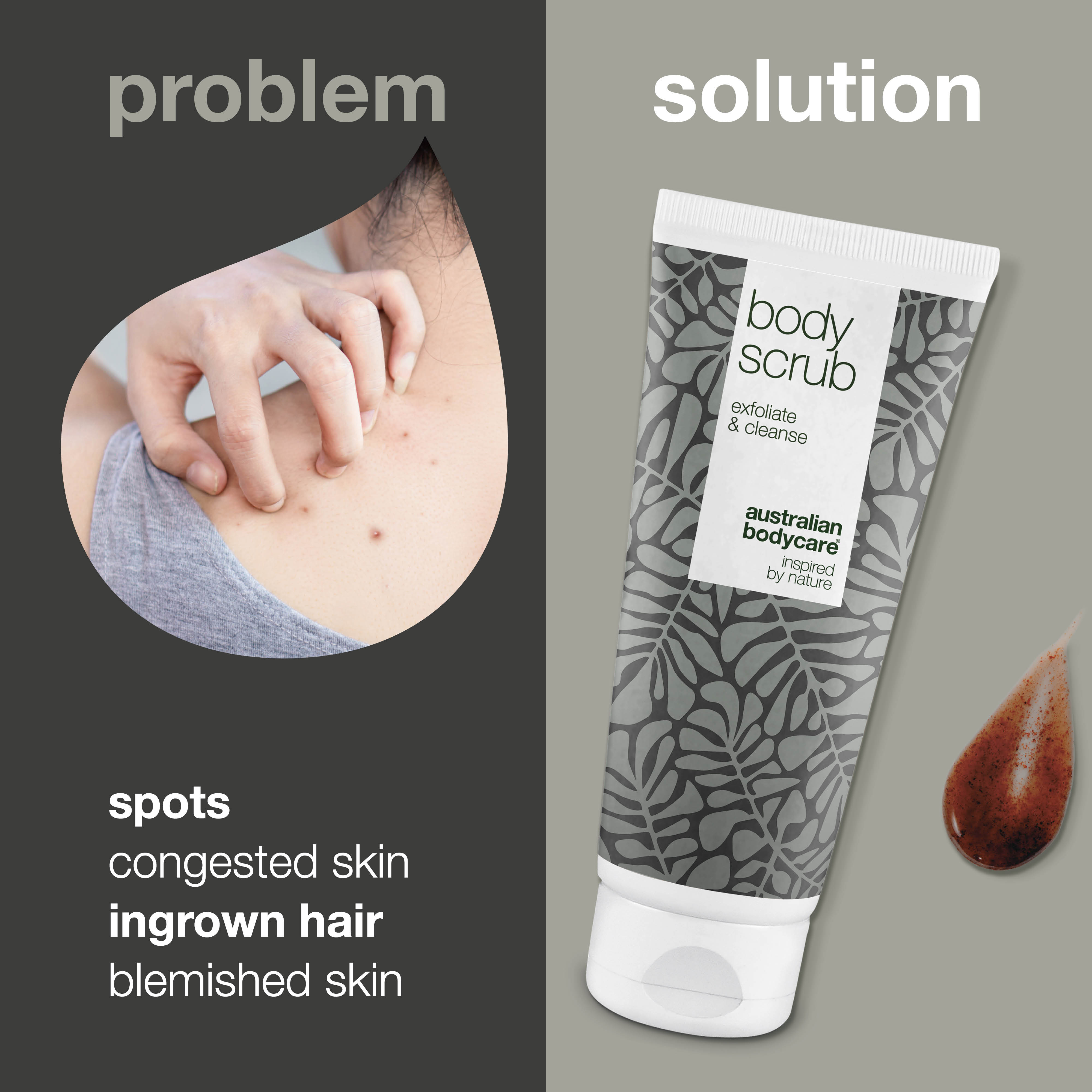 Derin Arındırıcı Vücut Peelingi — Gözenekleri Temizler, Pürüzlü Görünümü Azaltır