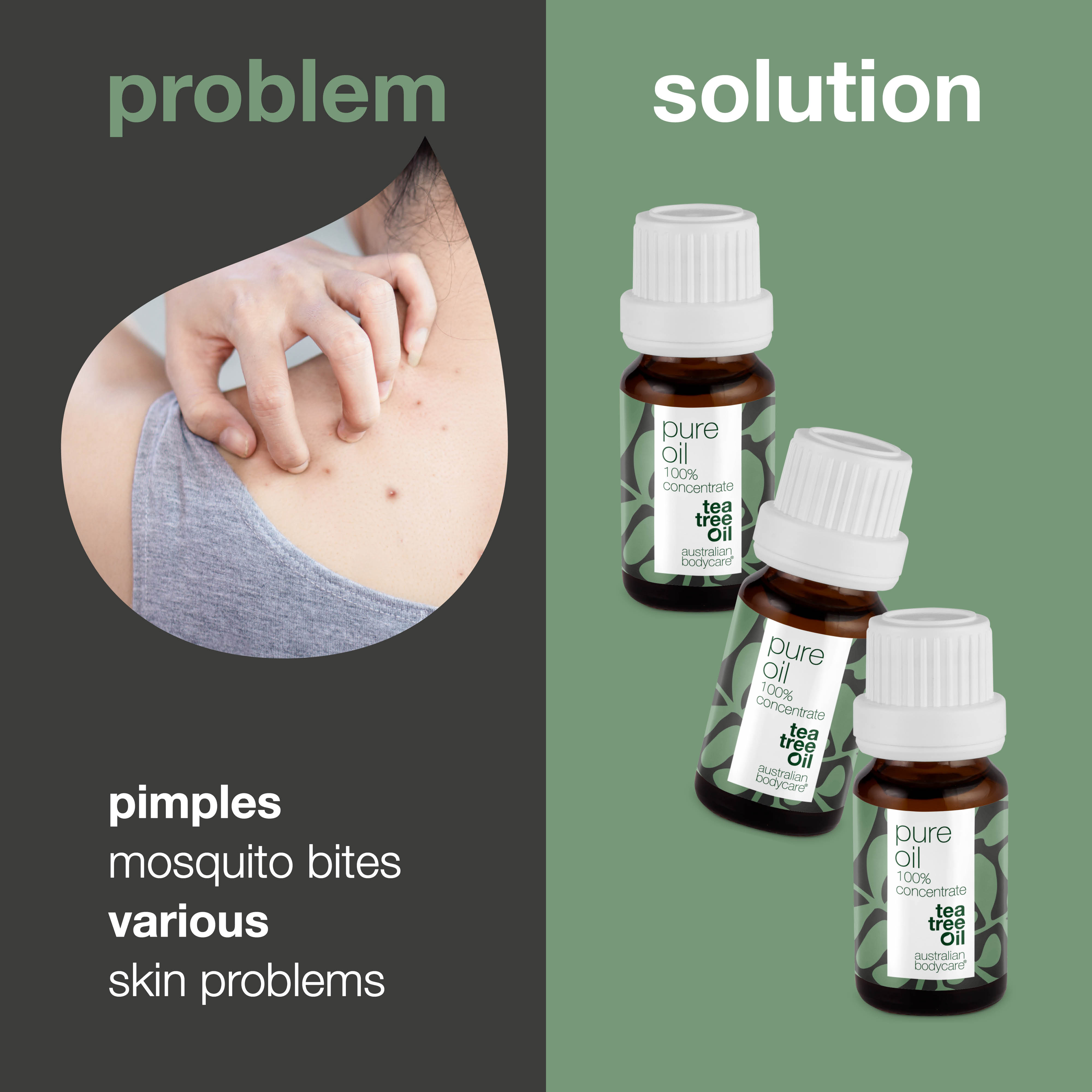 Cilt sorunları için 3 x XL 30 ml Çay Ağacı Yağı — Avustralya’dan %100 konsantre ve seyreltilmemiş çay ağacı yağı 3’lü paket