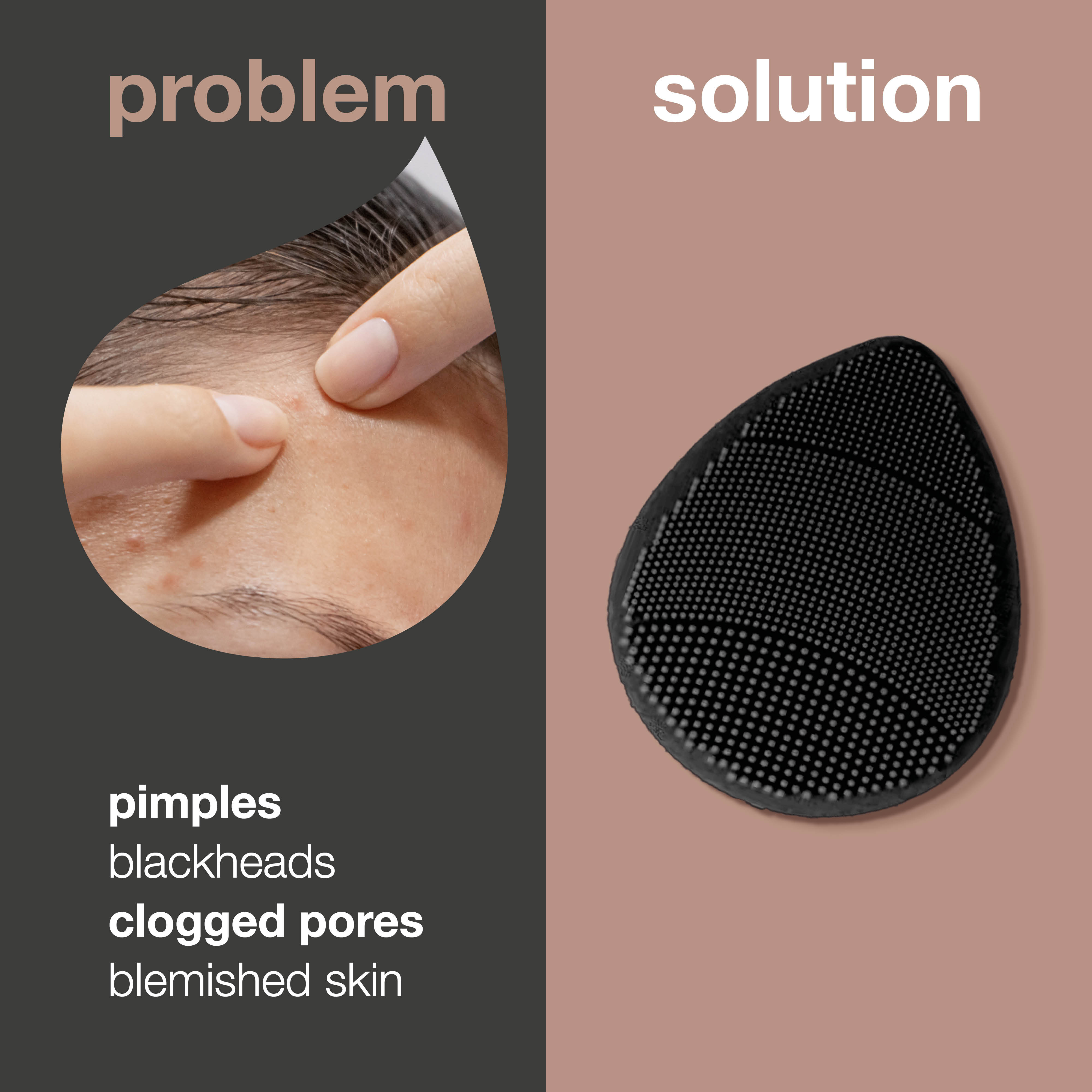 Yüz için peeling etkili yüz temizleme fırçası — Her gün nazikçe arındırmaya, ölü deriyi uzaklaştırmaya ve cildi pürüzlerden arınmış, daha pürüzsüz bir görünüme kavuşturmaya yardımcı olur