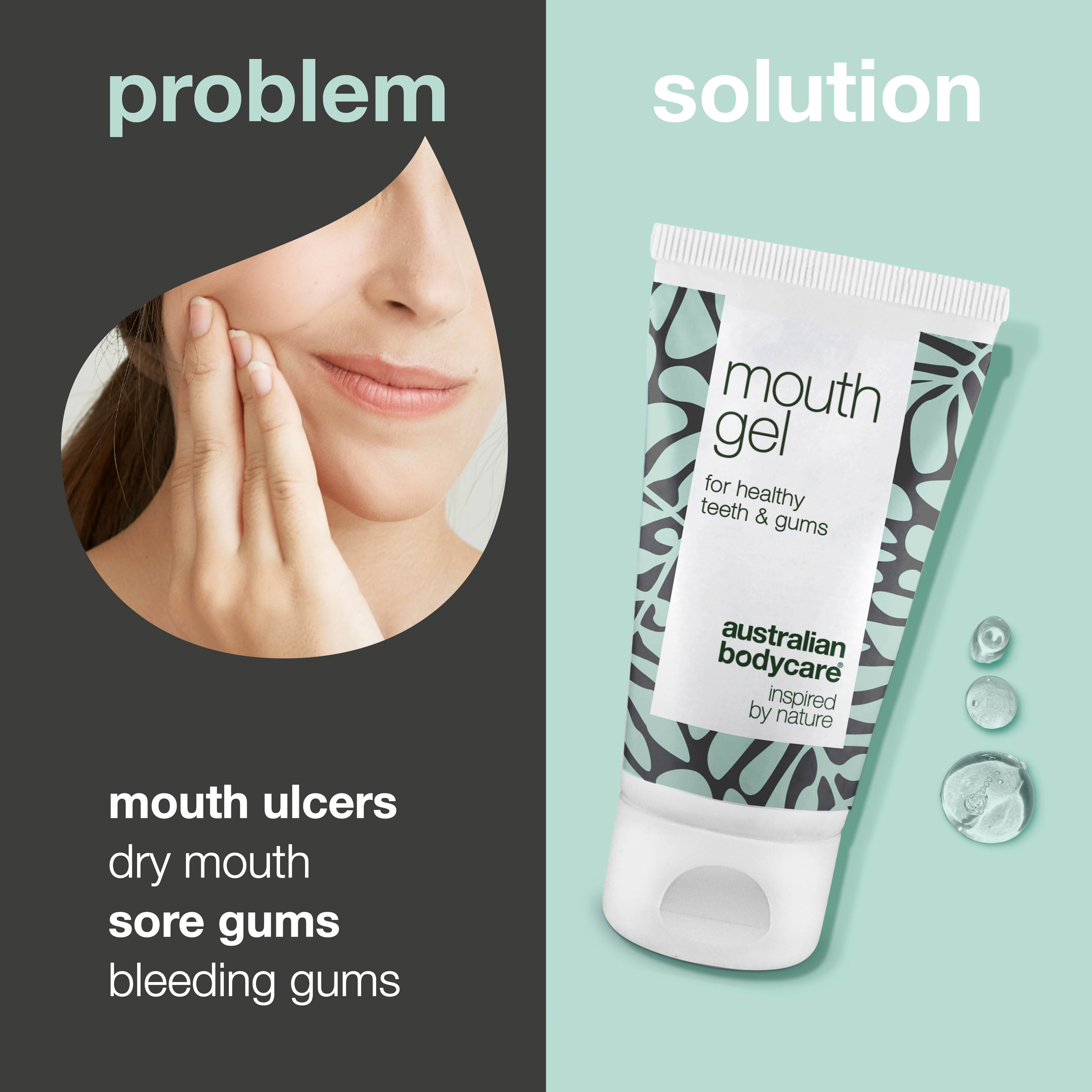 Ağız yaraları ve hassas diş etleri için yatıştırıcı ağız jeli — Aft, kuru ağız ve hassas diş etlerinin günlük bakımına yardımcı, rahatlatıcı ve ferahlatıcı jel formül