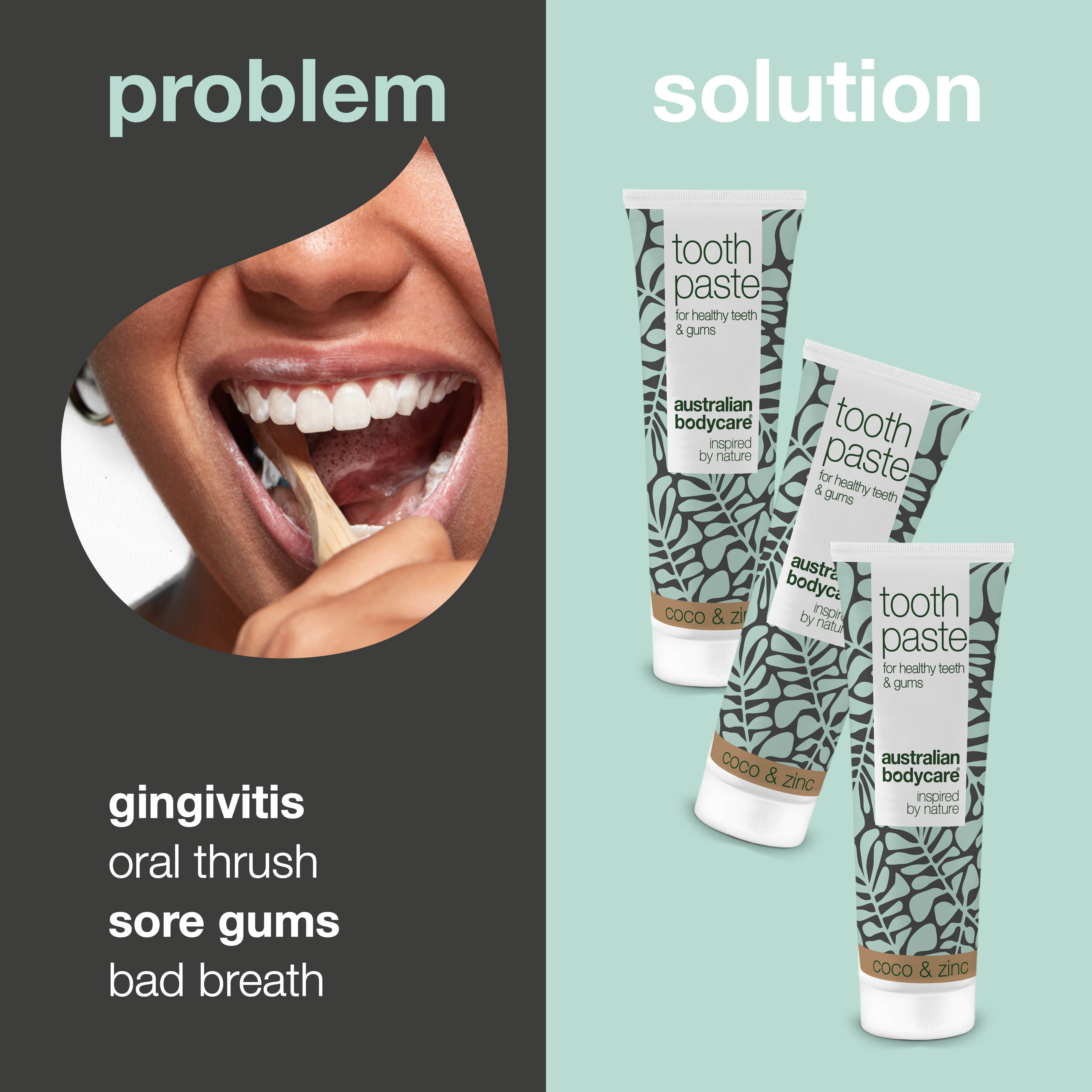 Diş eti sorunlarına özel diş macunu — Günlük bakım için formüle edilmiştir; periodontitis, mantar kaynaklı ağız sorunları ve diş eti iltihabının düzenli temizliğine yardımcı olur