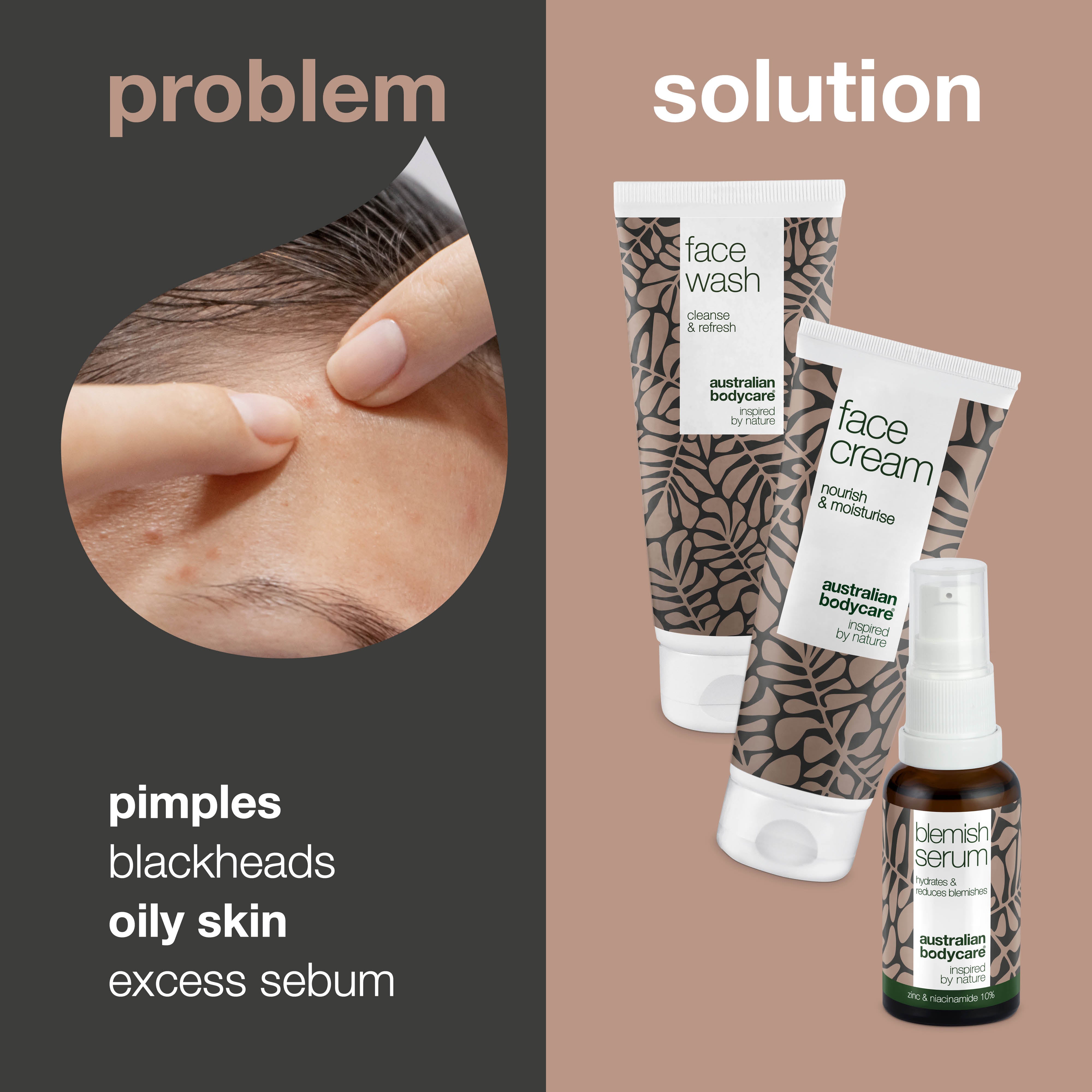 Sivilce ve yağlı cilt bakım kiti — Yağlı ve akneye eğilimli ciltler için günlük kullanımda parlamayı azaltmaya, gözenek görünümünü düzenlemeye ve cildi daha dengeli hissettirmeye yardımcı set