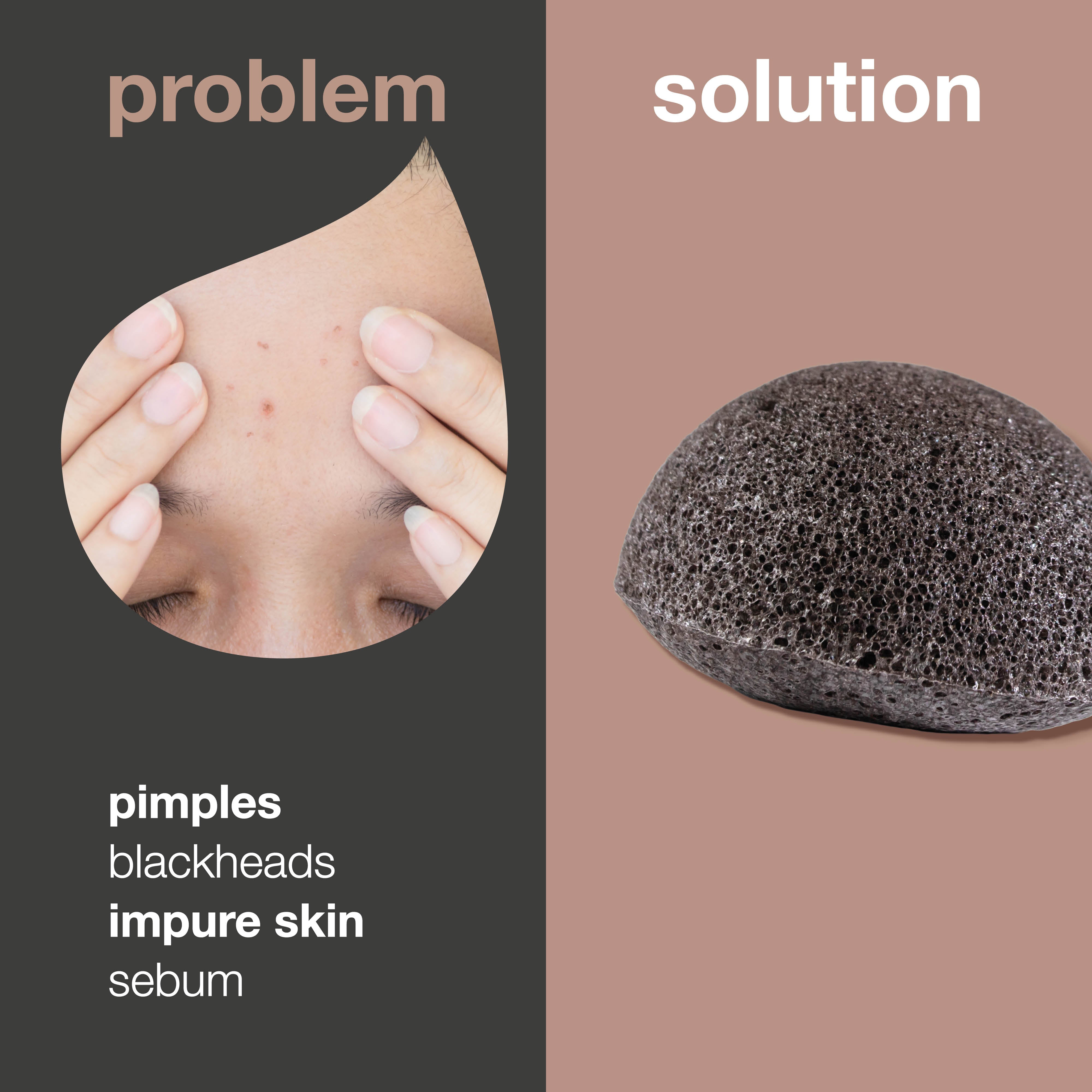 Cilt kusurları için konjak sünger – sivilce ve siyah noktalar için nazik peeling etkisi — Cildi tahriş etmeden arındırmaya, pürüzlü görünümü azaltmaya ve daha pürüzsüz bir dokuya destek olur