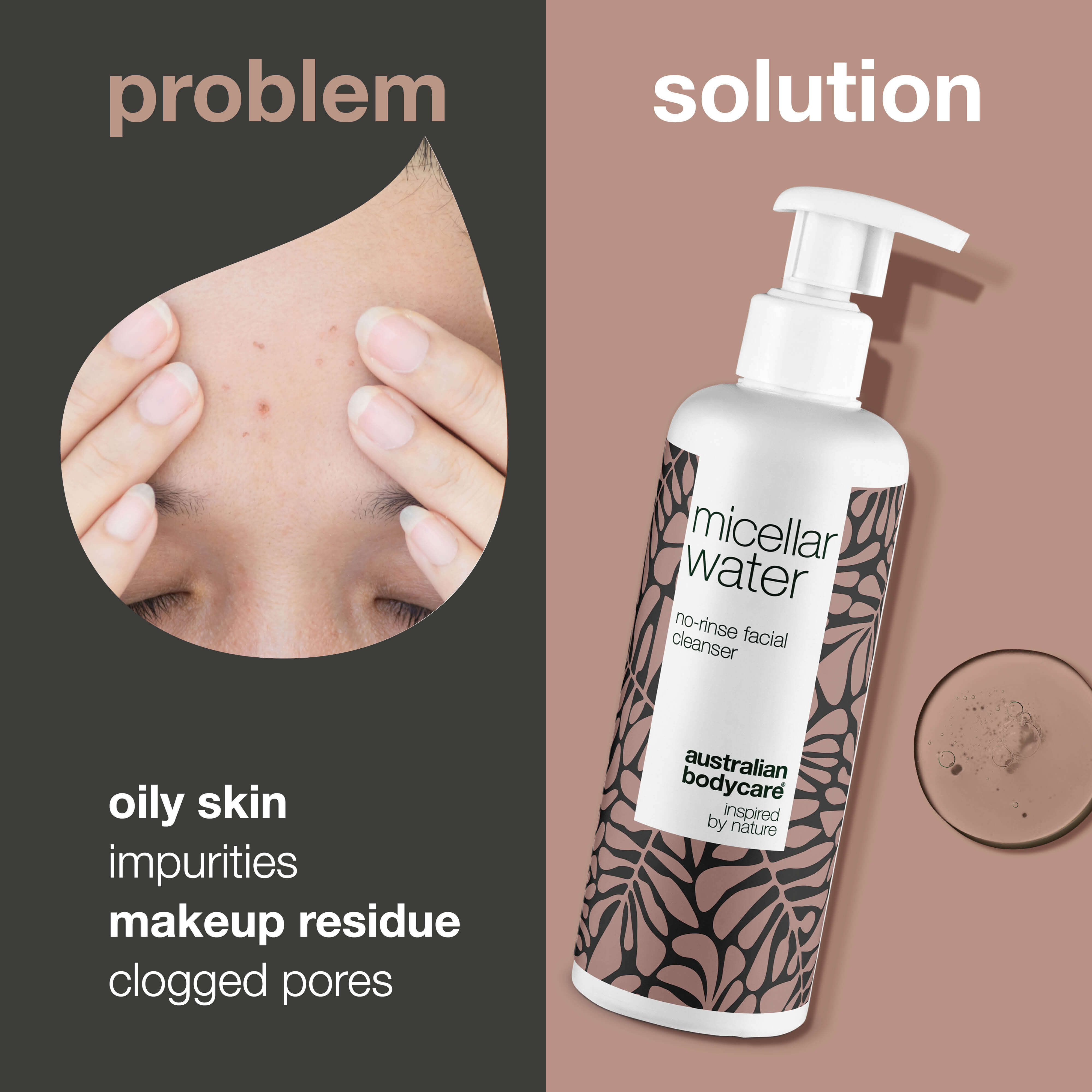 Yağlı ve sivilceye eğilimli ciltler için misel su temizleyici — Makyajı, kiri ve fazla yağı nazikçe arındırır; günlük kullanımda cildi ferah, dengeli ve temiz tutmaya yardımcı olur