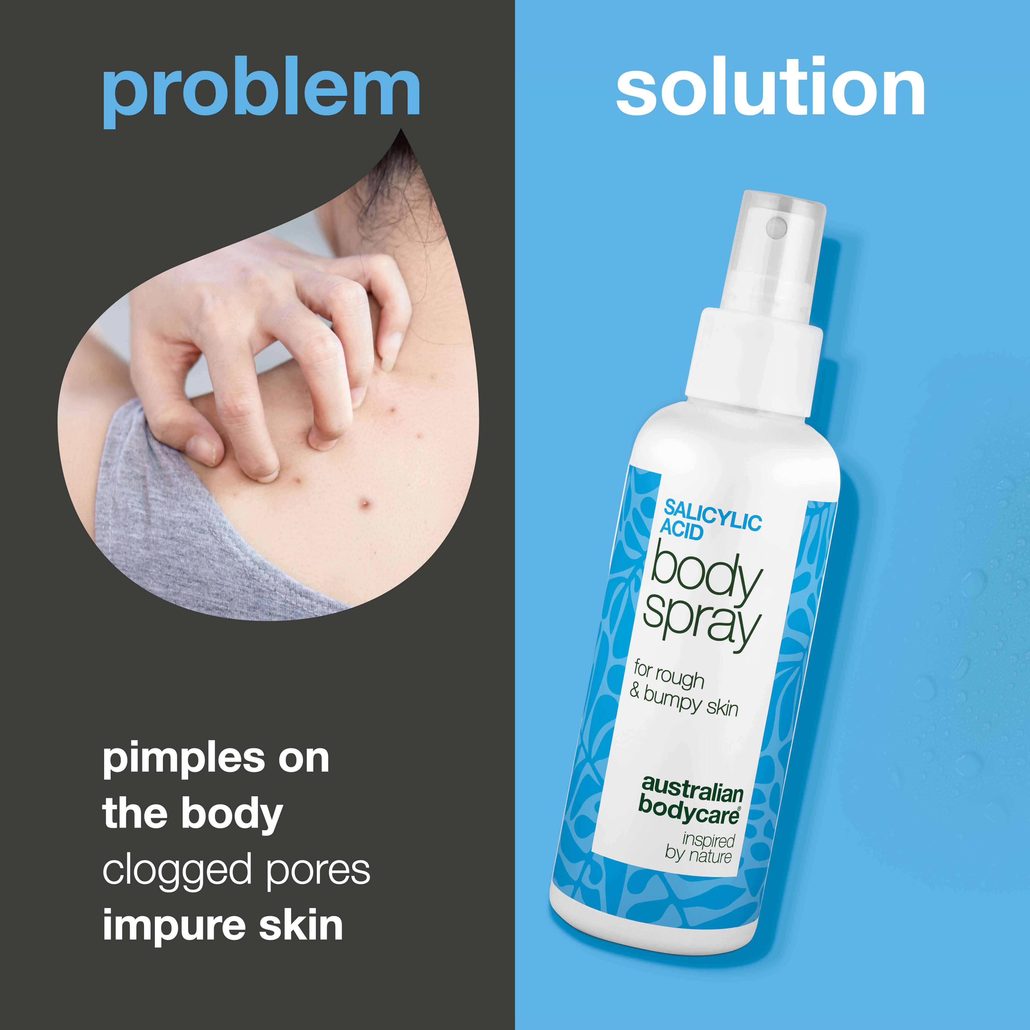 %2 Salisilik asit vücut spreyi, sivilceler ve tıkanmış gözenekler için — %2 salisilik asit ve glikolik asit içeren sprey, gözenekleri arındırmaya ve cildi pürüzsüzleştirmeye yardımcı olur