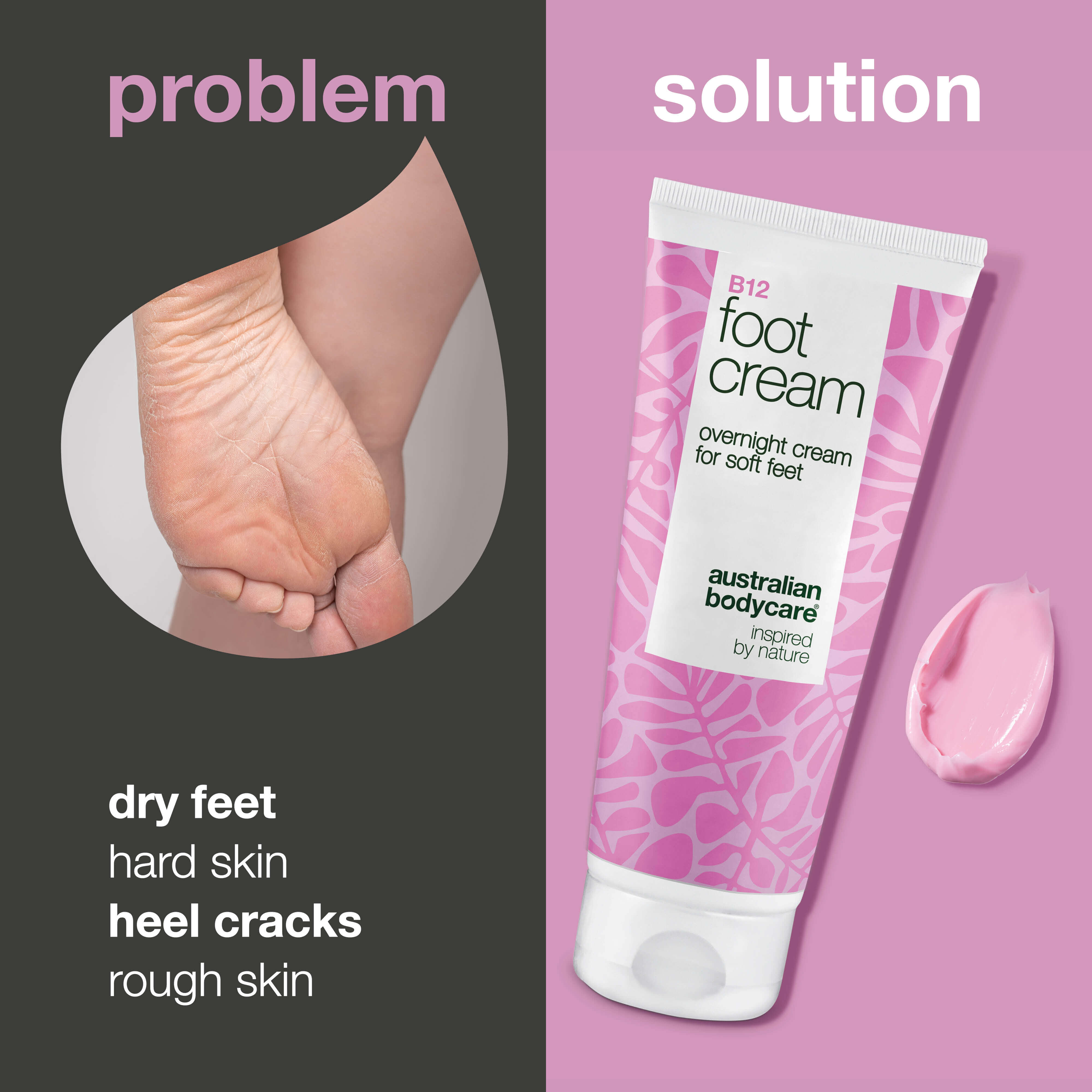 Vitamin B12 ve %10 Üre İçeren Ayak Kremi – Kuru ve sertleşmiş ayak derisini yumuşatmaya, pürüzlü görünümü azaltmaya ve gece bakımı ya da ayak banyosu sonrası yoğun nem sağlamaya yardımcı olur