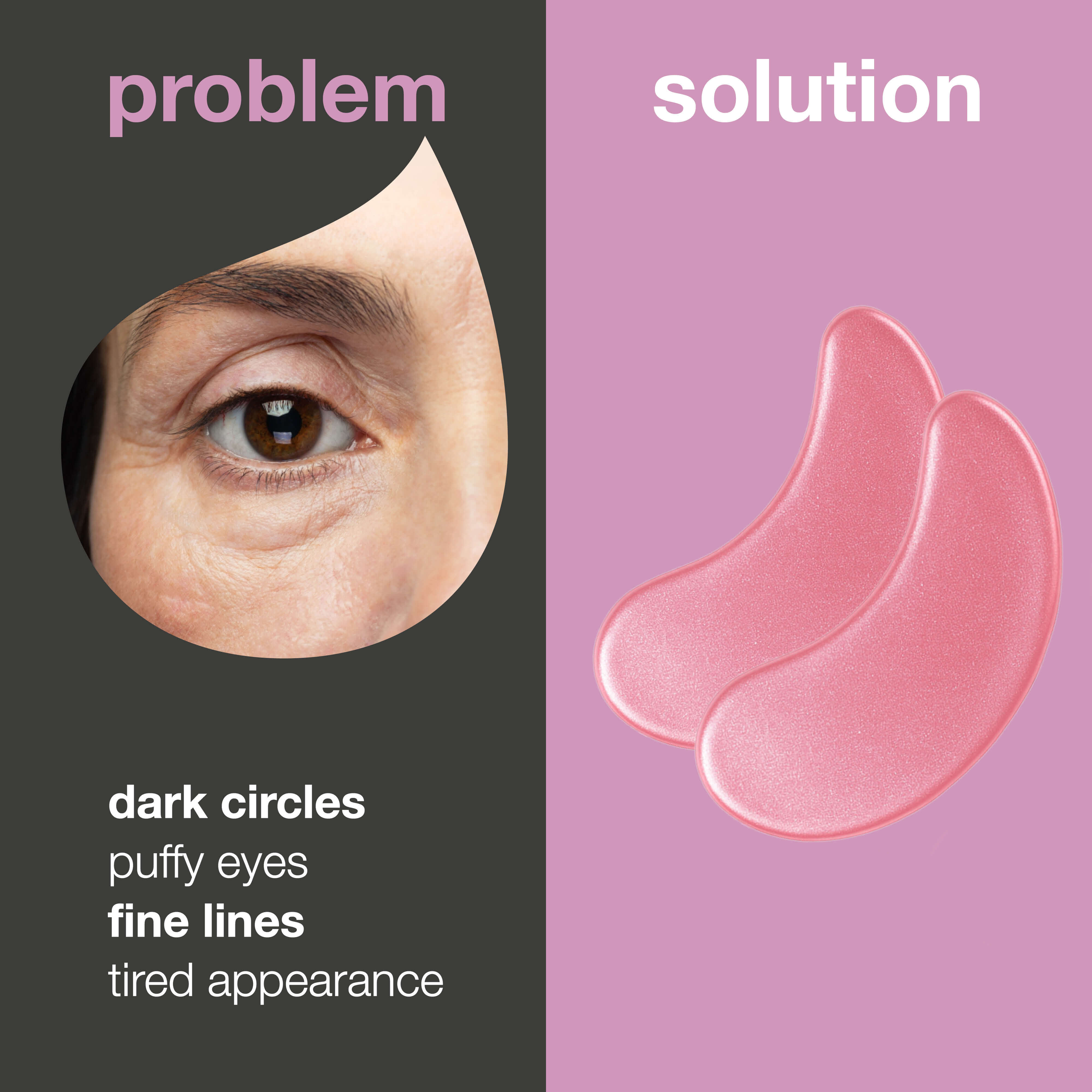 Vitamin B12 ve Kolajen Göz Altı Pedleri Koyu Halkalar ve Şişkinlik İçin — B12 göz pedleri koyu halkaların görünümünü azaltmaya, cildi 20 dakikada nemlendirip canlandırmaya yardımcı olur