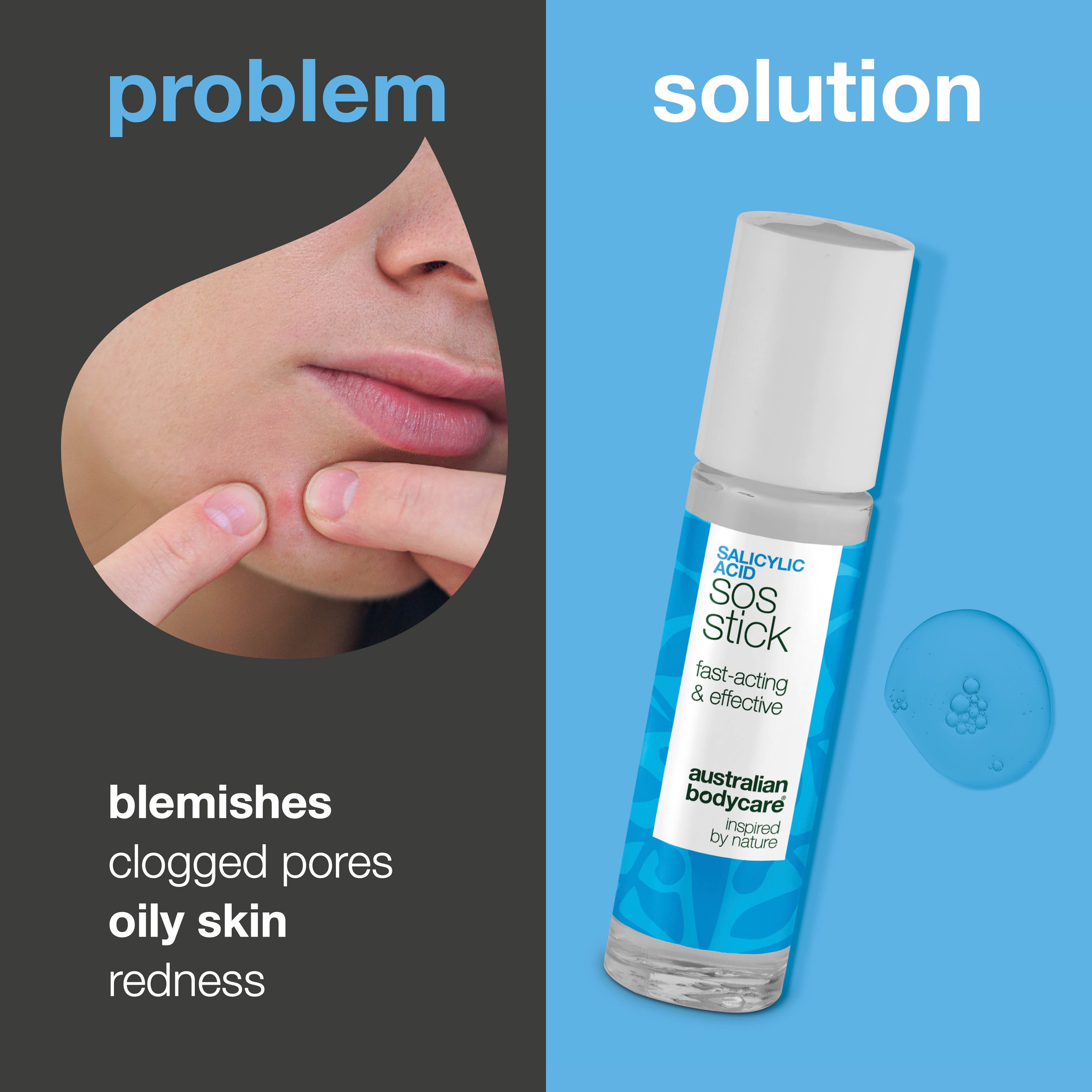 Salisilik Asitli Arındırıcı Stick — Akneye Eğilimli Ciltler İçin Hedefli Bakım