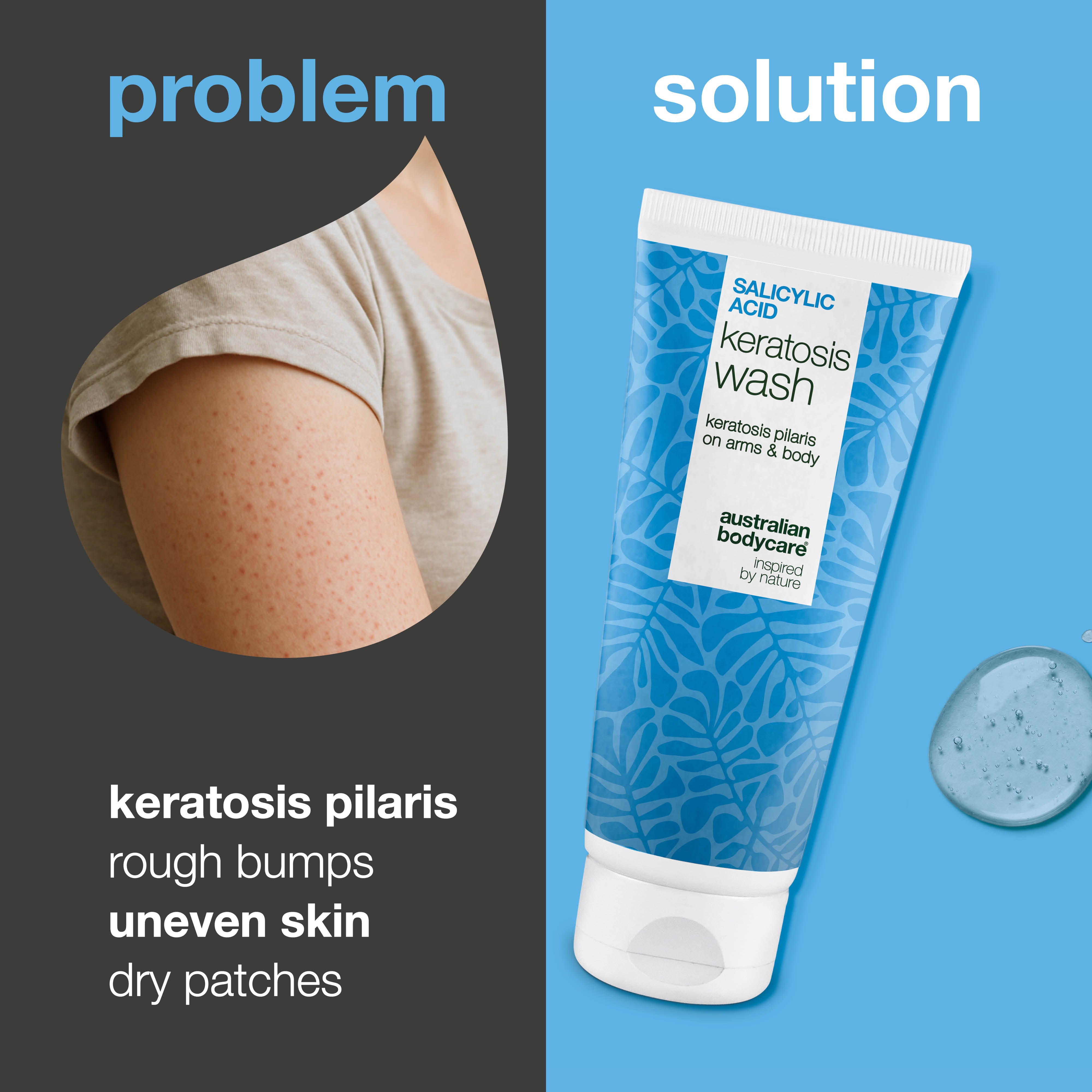 Keratosis Pilaris Vücut Yıkama Jeli – pürüzlü, kabarık ve kuru vücut derisi için günlük bakım, düzenli kullanımda cildi nazikçe arındırmaya ve daha pürüzsüz hissettirmeye yardımcı olur