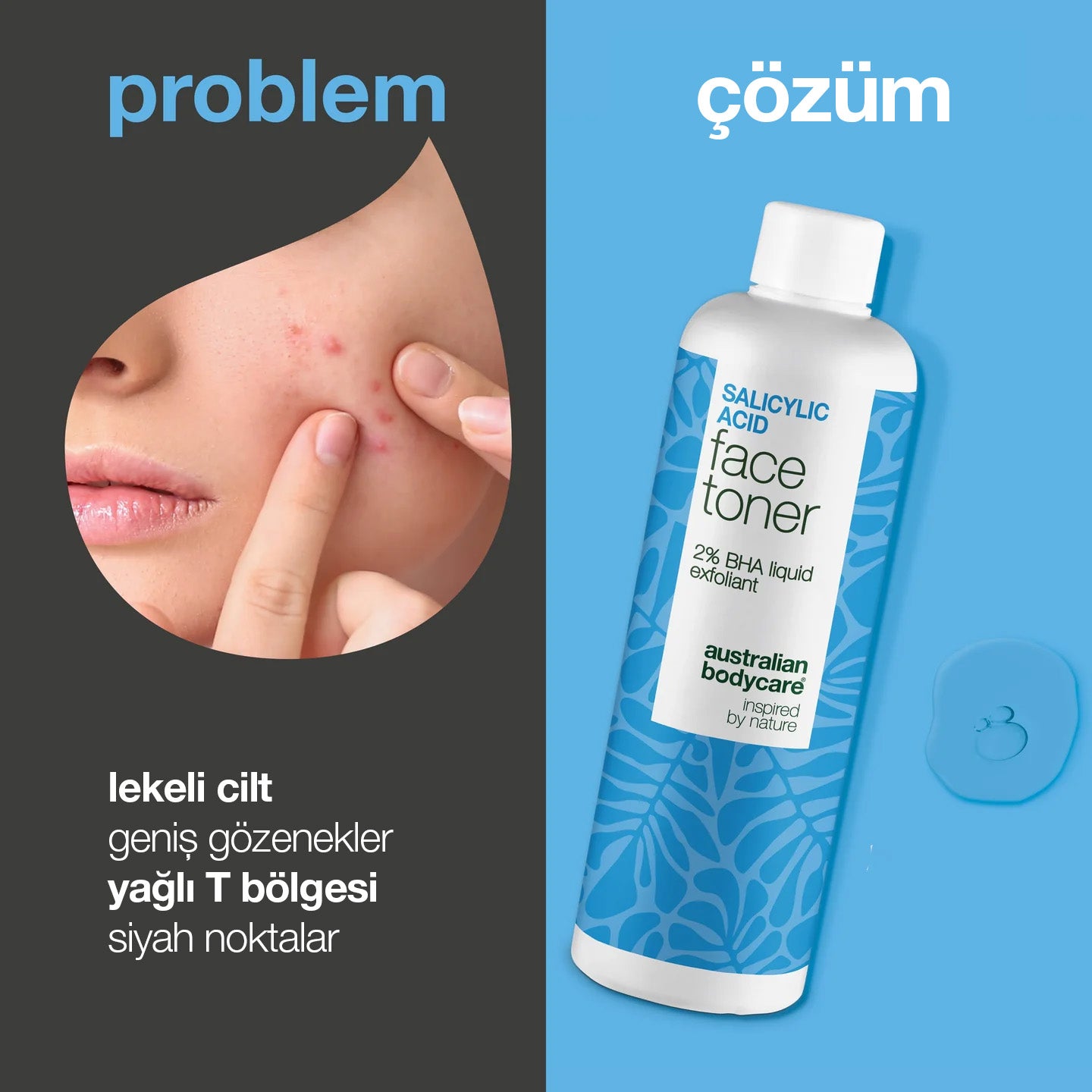 SALICYLIC ACID FACE TONER - Yüz Toniği — BHA peeling gözenekleri arındırır, sivilce görünümünü azaltır, cilt dokusunu pürüzsüzleştirir, düzenli kullanımda cildi daha netleştirir