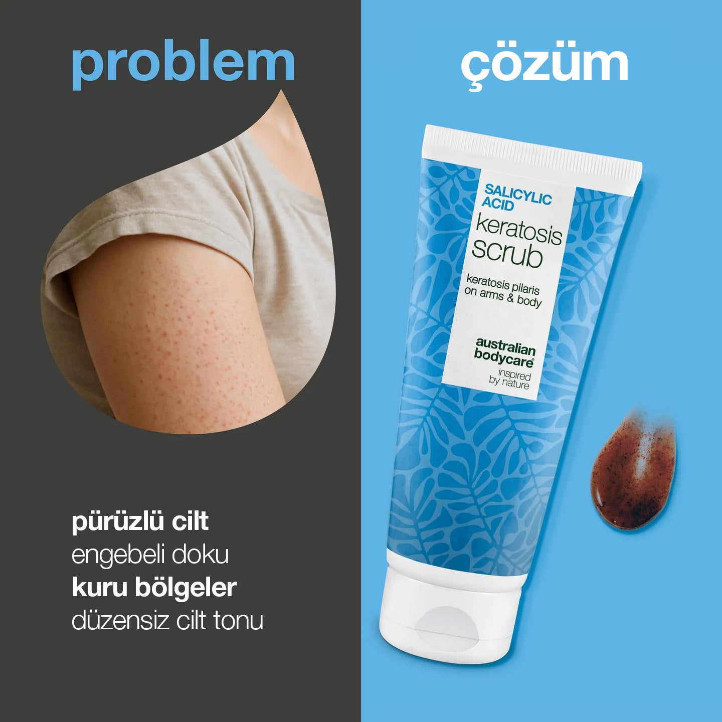 SALICYLIC ACID KERATOSIS SCRUB — Salisilik ve glikolik asit ile nazikçe arındırır, gliserinle yumuşatır, pürüzleri azaltmaya yardımcı olur