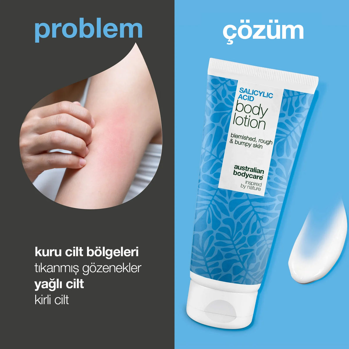 Salicylic Acid Body Lotion - Vücut Losyonu